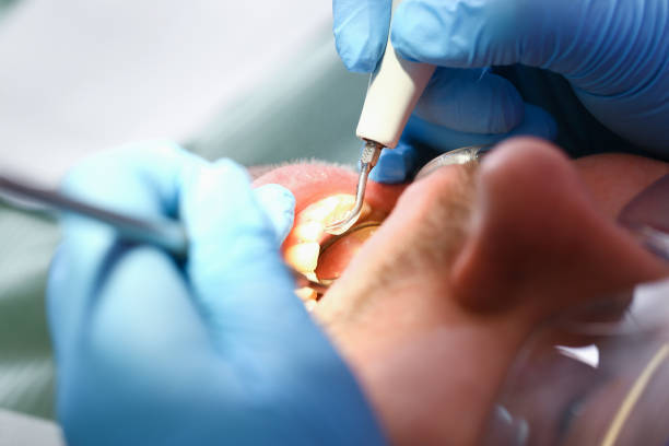 Best Emergency TMJ Treatment in Cloverly, MD