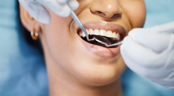 Best Emergency Gum Treatment in Cloverly, MD
