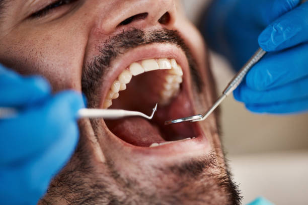 Best Emergency Treatment for Dental Infections or Abscesses in Cloverly, MD